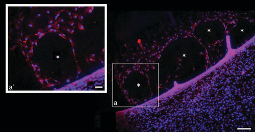 Figure 5. Immunostaining assay of lymphatic endothelial cells and vessel like structures.Representative image of positive LYVE1 expressing cells (red staining) in t48 human adipose-derived stem cell conditioned medium treated lymphatic endothelial cells. Blue DAPI staining indicates nuclei. (a’) shows higher magnification of (a), which highlights the red staining delimiting the borders of vessel-like structure.* = newly formed vessel-like structure.
