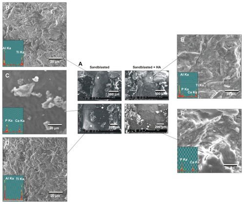 Figure 8 Morphological and elemental analyses of the sandblasted and sandblasted + hydroxyapatite-coated implant interfaces at late healing stage of week four by scanning electron microscopy and energy dispersive X-ray. (A) Representative low-magnification scanning electron microscopic images of the retrieved implants. (B–D) High-magnification scanning electron microscopic images and energy dispersive X-ray spectra of the sandblasted surfaces for the areas indicated in (A). (E and F) High-magnification scanning electron microscopic images and energy dispersive X-ray spectrum of the sandblasted + hydroxyapatite-coated implant surfaces for the areas indicated in (A).Abbreviations: Al, aluminum; Ca, calcium; HA, hydroxyapatite; P, phosphorus; Ti, titanium.