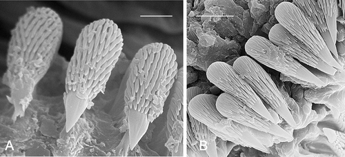 Figure 11. Uncini: Phisidia aurea (British Islands, Scale 3 μm); Proclea graffi (74°30′ N, 15°55′ E, 930 m, scale 10 μm).