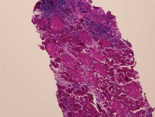Figure 2. PAS of glomerular cortex 10×.