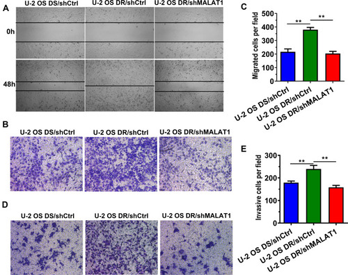 Figure 3 The doxorubicin-resistant cells exhibited better wound healing ability (A), migration ability (B and C), invasion ability (D and E), which could be reversed by downregulating MALAT-1.