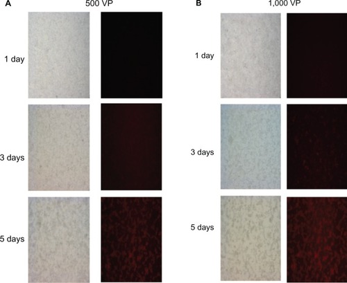 Figure 3 Replication ability of recombinant adenovirus Ad5/35PSES.mRFP/ttk. LNCaP cells were infected with 500 (A) or 1,000 (B) virus particles of recombinant adenovirus and monitored for 5 days after infection under fluorescent microscopy and light microscopy (20×).