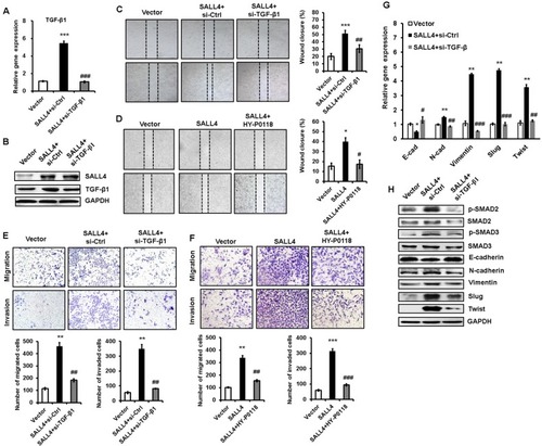 Figure 5 TGF-β1 mediates the promoting role of SALL4 in gastric cancer cell migration and invasion.Notes: (A, B) qRT-PCR (A) and Western blot (B) analyses of TGF-β1 expression in SALL4-overexpressing HGC-27 cells with or without TGF-β1 knockdown. (C, D) Cell scratch assay for the motility of SALL4-overexpressing HGC-27 cells with or without TGF-β1 knockdown (C) or HY-P0118 treatment (D). (E, F) Transwell migration and Matrigel invasion assays for the migration and invasion abilities of SALL4-overexpressing HGC-27 cells with or without TGF-β1 knockdown (E) or HY-P0118 treatment (F). (G, H) qRT-PCR (G) and Western blot (H) analyses of EMT markers and SMAD2/3 in SALL4-overexpressing HGC-27 cells with or without TGF-β1 knockdown. *P<0.05, **P<0.01, ***P<0.001, compared to vector group; #P<0.05, ##P<0.01, ###P<0.001, compared to SALL4 group.Abbreviations: EMT, epithelial–mesenchymal transition; qRT-PCR, quantitative real-time PCR.