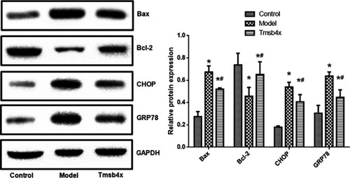 Figure 7 Exogenous Tβ4 reverses OGD/R-induced changes in ER and apoptosis-related protein expression. Upper panel: representative immunoblots; lower panel: quantitative analysis. Data shown as mean ± SD. *P<0.05 vs control; #P<0.05 vs OGD/R.