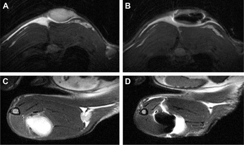 Figure 6 In vivo MRI of a tumor in the rat.Notes: (A and B) Axial images of the tumor on the back 2 weeks after subcutaneous injection of the tumor cells; (C and D) tumor in the hind leg 2 weeks after tumor cell injection. (A and C) Native MRI before injection of the nanoparticle suspension; (B and D) MRI after direct injection of the NP suspension into the tumor.Abbreviation: MRI, magnetic resonance imaging.