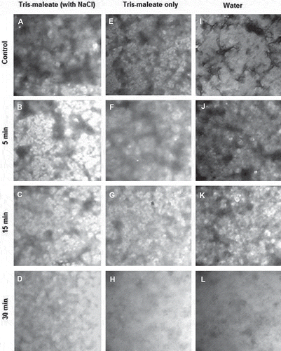 Figure 5. Transmission electron micrographs of actomyosin sonicated in tris-maleate (with NaCl), tris-maleate only and water