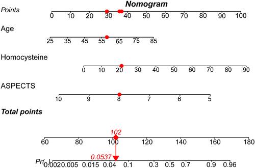 Figure 1 Nomogram model for the prediction of a device pass number > 3 during EVT. The nomogram was developed by assigning a graphic initial score to each independent predictor with a point range from 0 to 100, which was then summed to generate a total score and converted into a percentage representing the probability of a device pass number > 3 during EVT. For example, a patient aged 58 years, with a homocysteine level of 21 mmol/L and a baseline ASPECTS score of 8.0 would have a total of 102.0 points (29.0 points for age, 36.0 points for homocysteine, 37.0 points for baseline ASPECTS score). The probability of a predicted device pass number > 3 would be approximately 5.37% for this patient.
