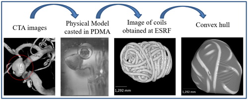 Figure 1. Summary of the method: starting with the CTA image on the left, and finishing with results of image analysis.