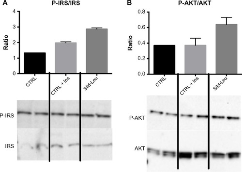 Figure 4 PDE5-inhibitors combined with Leu increases insulin signaling in vitro.