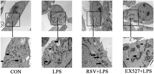 Figure 10. Effects of different treatments on mitochondrial structure in INS-1 cells by transmission electron microscope (×2 μm), the second row pictures were adapted from upper pictures (×1 μm). Arrows refer to mitochondria in different groups. Mitochondria became irregular, swelling and showed more disordered ridges induced by LPS. RSV pretreatment alleviated these damages, but EX527 pretreatment further damaged mitochondrial structure, showing more obscuring or even fragmentary outer membrane.