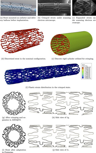 Figure 1. Xience V stent.