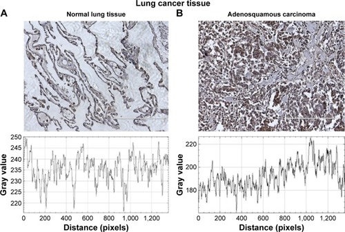 Figure 7 Evaluation of HPRT expression within patient tissue.