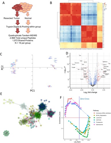 Figure 1 Proteomic profiling of colorectal cancer. (A) Resected samples from a pool of patients were pooled together and run through mass spectrometry, yielding a collection of 2,968 peptides that match to 1071 distinct proteins shared among all the samples. (B) Correlation matrix computed using Pearson correlation between each of the samples run. NA = normal stage II, NB = normal stage III, NC = normal stage IV, TA = tumor stage II, TB = tumor stage III, TC = tumor stage IV. ND and TD samples corresponded to mucinous adenocarcinoma sample. (C) Principal component analysis of the samples confirms the stratification of tumor and normal samples seen in simple correlation analysis, while also separating out the mucinous adenocarcinoma tumor samples from the rest. (D) Volcano plot visualization of the differentially expressed genes between normal and tumor samples reveals an upregulation in some factors associated with basic cellular processes, such as PCNA and EIF3b. (E) Network analysis of proteins upregulated in tumor samples using ReactomeFI as visualized in Cytoscape identifies several classes of proteins that are highly related. (F) Gene set enrichment analysis for KEGG pathways that are differentially expressed across all normal vs tumor samples. Positive enrichment score indicates enrichment in tumor samples. The top 3 varied pathways in either direction are shown here, and are statistically significant with FDR <10% and p-value <0.05.
