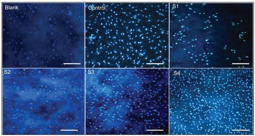 Figure 11 Fluorescence photomicrograph of control fibroblasts, fibroblasts treated with blank, S1, S2, S3, S4 films and control (without film) for 3 days.Note: Scale bar, 20 μm at 50× magnification.