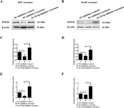 Figure 3 Let-7b-5p inhibitor reverses the exosome-induced decrease of RNF20 expression in C2C12 myotube cells. (A–D) Western blotting results of RNF20 expression in C2C12 myotube cells co-cultured with KPC exosomes (left) or Pan02 exosomes (right) after treatment with let-7b-5p inhibitor and quantification of the protein bands, and β-actin was used as a control; (E–F) qRT-PCR detection of RNF20 mRNA expression in C2C12 myotube cells treated as in A and B. *P < 0.05, **P < 0.01.