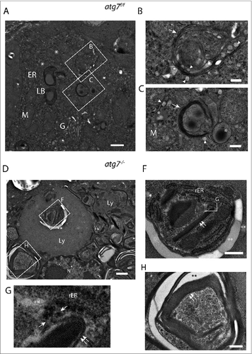 Figure 4 (See previous page). Ultrastructure of ductal Harderian gland cell. (A) Type B HaGl cell containing multilamellar bodies (LB) with a woolly appearance in different stages of maturation. (B) Nascent lamellar body of an early stage. During the formation of these secretory vesicles, small primary lysosomes (white arrowhead) fuse with the nascent lamellar body containing a few lamellae (white arrow). (C) Nascent lamellar body of a later stage. Further lamellae (white arrow) are acquired by the incorporation of dark lipid drops (*) and the fusion of lysosomes (white arrowhead). (D) Tertiary lysosomes in atg7−/− HaGls. A tertiary lysosome (Ly) adjacent to the nucleus occupies a large area of the cytoplasm in an autophagy-deficient mouse. The content of this vacuole is not fully homogeneous, but has several pieces of membrane stacks and lipids (**). This 7-μm spanning compartment is separated from the cytoplasm by a unit membrane and has a further inclusion (E). In addition, tight lamella stacks, lipid clefts and smaller tertiary lysosomes are observed in the cytoplasm of this cell. (E) Inclusions of the tertiary lysosome. The enlarged area displays rough endoplasmic reticulum (rER), tight lamella stacks (double arrows), lipid inclusions (**) and electron dense areas potentially originating from disassembled lamellae. (F) High magnification of tight lamella stacks revealed that they are continuous with the rough endoplasmic reticulum (rER), where ribosomes are stripped off at a certain site (opposing arrows). (G) Further tight lamellar ER stacks (double arrows) with additional inclusions of rER and lipids (**). LB, multilamellar body; rER, rough endoplasmic reticulum; M, mitochondria; G, Golgi; arrowhead, primary lysosome; arrow, lamella; Ly, tertiary lysosome; LD, lipid droplet of an adjacent cell; N, nucleus; opposing arrows, demarcation line between rough endoplasmic reticulum and lamellar stacks; double arrows, tight lamella stacks; *, small electron dense/dark lipid drop; **, lipid inclusions. Size bars: 1 μm ((A)and D), 500 nm (B, C, (E)and G).