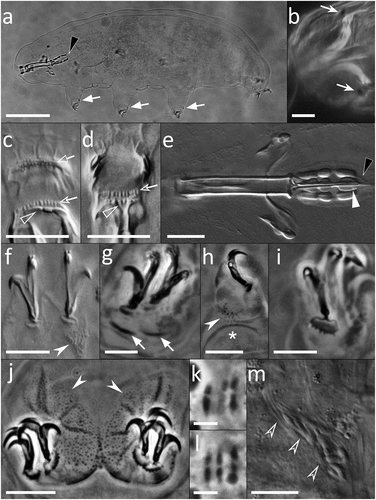 Figure 2. Paramacrobiotus bifrons sp. nov., animal morphology with LM. (a) holotype in toto; (b) eyespots visible in vivo; (c) buccal armature, dorsal view; (d) buccal armature, ventral view; (e) buccal-pharyngeal apparatus; (f) claws of the first pair of legs; (g) claws of the second pair of legs; (h) leg and claw of the third pair, internal side; (i) claws of the fourth pair of legs; (j) fourth pair of legs; (k-l) orcein-stained chromosomes, different planes of the same oocyte; (m) sperms within a sperm duct visible in vivo. Black arrowheads: filament departing from the third macroplacoid; white arrows: cuticular bars under claws; white indented arrows: eyespots; empty arrow: first band of teeth; empty indented arrows: second band of teeth; empty arrowheads: transversal crests; white arrowhead: constriction on the third macroplacoid; white indented arrowheads: granulation on legs; asterisk: pulvinus; empty indented arrowhead: sperms within a sperm duct. a, g–l: PhC; b–f, m: DIC. e–h, j: z-stacks. Scale bars: a = 50 µm; b, e–j, m = 10 µm; c–d = 5 µm; k–l = 2.5 µm.