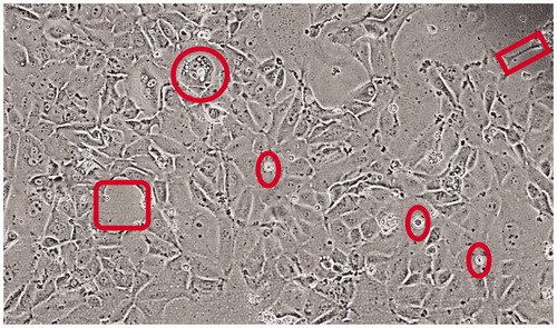 Figure 1. STAR cells in culture – morphology. Micrograph shows the diversity of STAR cells, with a somewhat cuboidal appearance of lung epithelium but with frequent large gaps between cells and clusters (square to the left) and lengthy dendritic-like connections to neighboring cells (rectangle to the upper right). The circle denotes a large cuboidal cell with numerous vacuolar intracellular structures, and ovals point out (viable) floating cells.