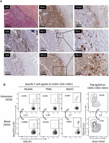 Figure 4. On-treatment metastasis (week 20) analysis in patient 0101