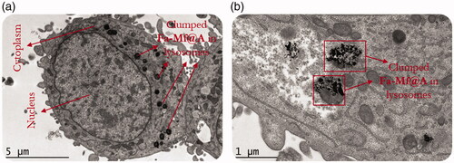 Figure 12. (a) CryoEM image showing the Fa-Mf@A clusters, (b) High-resolution CryoEM image showing the engulfed cluster of Fa-Mf@A inside the lysosome by the process of endocytosis. Mf@A: MnFe2O4@Au nanoparticles.
