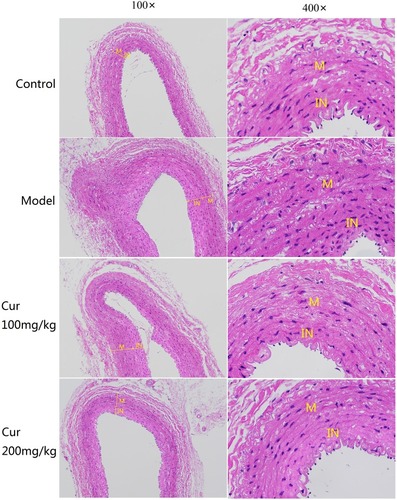 Figure 4 Observation of rabbit carotid vessel by HE staining (100×and 400×).