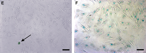 Figure S2 Senescence investigation.Notes: Microscopic images of B16F10 cells after treatment, for 72 hours, with PBS (A), DMSO (B), ND (200 μg/mL) (C), ND + C (200 μg/mL) (D), C (640 μM) (E), and DOX (F). In green were evidenced, by a specific kit, the senescent cells. The arrows indicate single cells showing the senescent phenotype. The black bars indicate 45 μm.Abbreviations: PBS, phosphate-buffered saline; DMSO, dimethyl sulfoxide; ND, nanodiamond; C, citropten; DOX, doxorubicin.