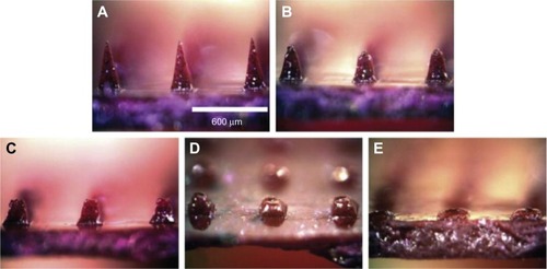 Figure 2 (A–E) Commonly seen dissolving microneedles and the drug-release procedure.