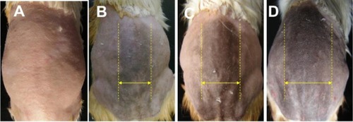 Figure 5 Photographs of skin appearance. (A) Day 7 post-irradiation. (B) Day 14 post-irradiation. (C) Day 21 post-irradiation. (D) Day 24 post-radiation. The hyperpigmentation area is indicated with yellow dashed lines and arrows.