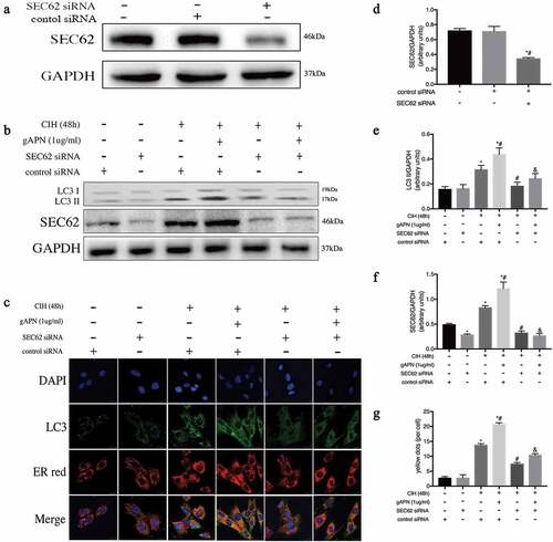 Figure 4. Role of SEC62 siRNA transfection on ER-phagy in H9C2 cardiomyocytes exposed to CIH (48 h), or with gAPN (1 µg/ml). (a, d) Protein level of SEC62 to verify transfection efficiency. (b, e–f) Protein levels of LC3-II and SEC62. (c, g) Fluorescence staining of LC3 (green) co-localized with the ER probe (red). Nuclei were stained with DAPI (blue). The scale bars represent 20 μm. Data represent mean ± SD. n = 3. *P< 0.05, vs control siRNA group. #P< 0.05, vs CIH+ control siRNA group. &P< 0.05, vs CIH+gAPN+control siRNA group