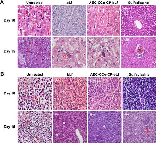 Figure 2 Histpathological analysis in liver and spleen at day 10 and 15 post infection.Notes: (Ai) Liver histopathology of untreated group of mice at day 10 postinfection showing the presence of tachyzoites (marked with red arrows). (Aii–iv) Liver histopathology of treatment groups showing no sign of inflammation or parasite at day 10 post infection. (Av) Untreated control group showing huge number of infected macrophages marked by red arrows. (Avi–vii) bLf and NCs treatment groups showing development of bradyzoites or tissue cyst inside the macrophages (kupffer cells) marked by red arrows. (Aviii) Sulphadiazine treatment group showing no infection but sign of inflammation marked by red arrow. Figure B. (Bi) Untreated Liver cells showing multiple sites of tachyzite multiplication (red arrows). (Bii–iv). Treatment groups showing no sign of inflammation or infection. (Bv) Liver histopathology at day 15 post infection showing multiple sites (50%) with tachyzoites marked with red arrows. (Bvi–vii) No parasite infection shown in treatment groups, however, inflammation was seen in sulphadiazine group (Bviii) marked as red arrow.Abbreviations: AEC-CCo-CP-bLf, alginate chitosan calcium phosphate bovine lactoferrin; bLf, bovine lactoferrin; NO, nitric oxide.