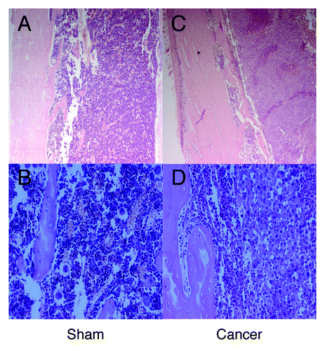 Figure 3. Hematoxylin and eosin staining in the rat femur at day 14 post-surgery. Panels (A) and (B) demonstrate the sham surgery group showing healthy bone structures. And panels (C) and (D) demonstrate that breast cancer cells filled the intramedullary space of the femur. (A and C: original magnification 40× ; B and D: original magnification 200× ).