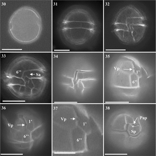 Figs 30–38. Alexandrium minutum from Scottish waters, identified using light microscopy with epifluorescence. Fig. 30. General cell shape. Fig. 31. Dorsal view of cell. Fig. 32. Ventral view showing 1′, 6′′ and Sa. Fig. 33. Ventral view of cell showing sulcal plates and descending cingulum. Fig. 34. Ventral view showing descending cingulum. Fig. 35. Long and narrow 1′ with clear ventral pore and 6′′ plate. Figs 36, 37. Narrow 1′ and 6′′ plates. Fig. 38. Antapical view showing Sp with attachment pore. Scale bars represent: Figs 30–36, 38, 10 µm; Fig. 37, 5 µm.