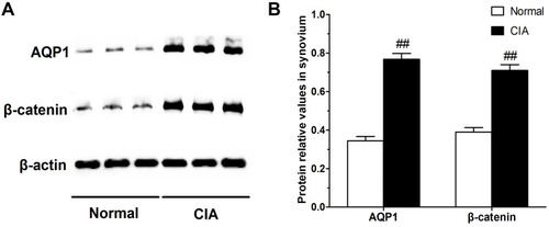 Figure 2 Western blot analysis for AQP1 and β-catenin protein in synovial tissues. (A) Typical examples of AQP1 and β-catenin protein expression in synovial tissues from normal and CIA rats. (B) The quantitative analysis of AQP1 and β-catenin protein relative values, β-actin serves as the house-keeping protein. Data are mean ± SEM (n = 6). ##P < 0.01 compared with normal rat group.