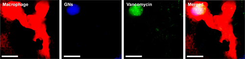 Figure S3 A zebrafish macrophage (red) containing internalized fluorescently labeled gelatin nanospheres (GNs, blue) and fluorescent-labeled vancomycin (green) at 24 hours after intramuscular injection of vancomycin-loaded GNs into a 3-day-old zebrafish larva. Scale bars represent 10 μm.