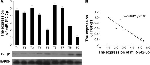 Figure 5 miR-542-3p expression is negatively correlated with TGF-β1 expression in fresh HCC tissues.