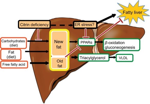 Figure 3 Fatty liver in citrin deficiency.