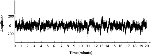 Figure 3. Normal brain activity the pulses was between −200 µV to 200 µV.