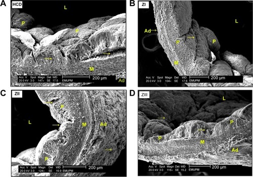 Figure 27 Three-dimensional scanning electron micrograph of aortas from HCD (A), ZI (B), ZII (C), and ZIII (D) groups.