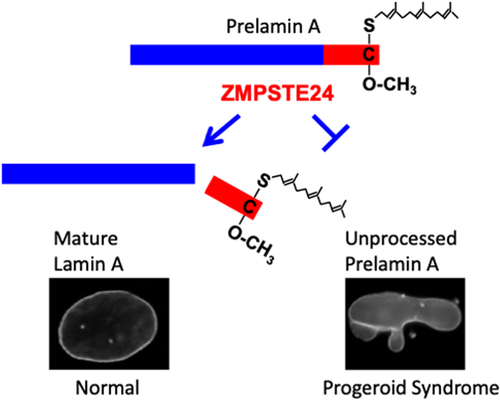 Figure 1. The processing of prelamin a in normal and progeroid cells. The post-translational processing steps leading to farnesylated and carboxyl methylated prelamin a (top) are described in the text. The final enzymatic reaction in prelamin a processing is the ZMPSTE24-catalyzed cleavage of prelamin A to generate mature lamin A (blue) and a 15-amino acid farnesylated and carboxyl methylated polypeptide (red) (left). This cleavage does not occur in cells lacking ZMPSTE24 or with a with a LMNA mutation that blocks cleavage (right). The farnesylated and carboxyl methylated cysteine is indicated. At bottom, fluorescence micrographs show that nuclei from cells expressing GFP-lamin a have a normal ovoid shape (left) whereas nuclei from cells expressing an unprocessed form of GFP-tagged prelamin a are aberrantly shaped (right).