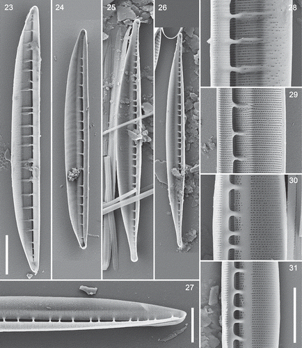 Figs 23–31. Interior views of type A and B valves and Nitzschia spathulata, SEM. Figs 23, 28. Type A1 (N. dicrogramma), valve and detail: note the greatly extended fibulae, which fork distally, and the sparsely and irregularly porous dorsal striae. Figs 24, 29. Type A2 (N. brachygramma), valve and detail, showing simple, orderly, uninterrupted striae. Figs 25, 30. Type B (N. parkii), valve and detail: note the plain strips bordering the fibula bases and interrupting the striae. Figs 26, 31. Type B: narrower variant. Fig. 27. Nitzschia spathulata. Scale bars = 10 µm (Figs 23–26, bar in Fig. 23) and 5 µm (Fig. 27; Figs 28–31, bar in Fig. 31).