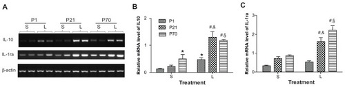 Figure 5 Relative mRNA expression of anti-inflammatory cytokines in the lung of P1, P21, and P70 animals. P1, P21, and P70 animals were treated with saline (S) or 0.25 mg/kg lipopolysaccharide (L) for 2 hours. Relative mRNA levels of IL-10 (A and B) and IL-1ra (A and C) in the lung of these animals were measured by semiquantitative reverse transcription PCR.