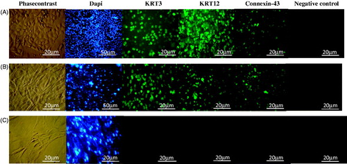 Figure 6. Immunocytochemistry of KRT3, KRT12, Connexin 43, DAPI and negative control (NC) for eyelid fat derived stem cells (EFDSCs) after culture on the (A) non-oriented nanofibrous gelatin mat, (B) oriented nanofibrous gelatin mat, and (C) control (TCPS).