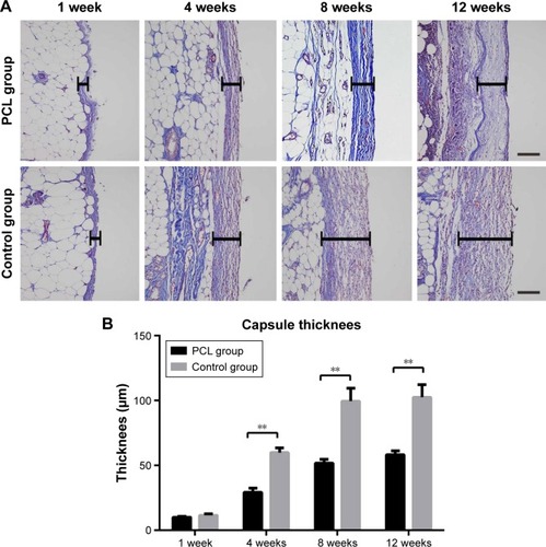 Figure 8 Changes in capsule thickness at different times.Notes: The thickness of the capsule reached the peak at week 8, and then remained almost unchanged from weeks 8 to 12 (A). Statistical analysis demonstrated that the adipose flap capsule of the control group was much thicker than that of the PCL group from weeks 4 and 12. All data were expressed as mean ± standard deviation. **P<0.001 compared between PCL group and control group. Results are in response to an analysis of Student’s t-test of both groups (B). Scale bar =100 μm.Abbreviation: PCL, polycaprolactone.