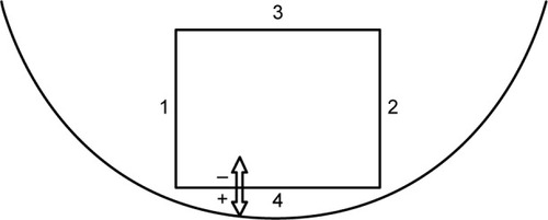 Figure 2 Schematic drawing of the chronology of the clear corneal incision measurements.