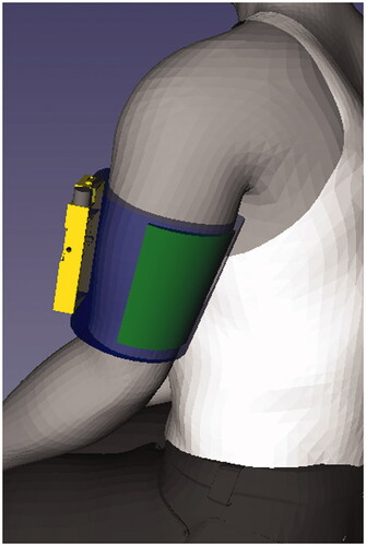 Figure 3. Illustration of the relative size and positioning of SHAPES system in order for the treatment to be administered (stimulator in yellow, electrode array in green, arm sleeve in blue).