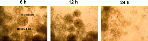 Figure 13. Images of GFP-expressing HEK293 cells released from porous PLGA microspheres obtained using an inverted phase contrast microscope at 6, 12 and 24 h after injecting the cell-loaded porous microspheres into a 48-well plate.