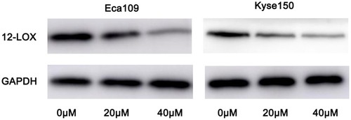Figure 1 Expression of 12-LOX was inhibited by Baicalein in a concentration-dependent way in ESCC cells. The left panel showed that the expression levels of 12-LOX in Eca109 cells were gradually inhibited after treated with 20 µM and 40 µM Baicalein, and right panel indicated similar results observed in Kyse150 cells.Abbreviation: ESCC, esophageal squamous cell carcinoma.