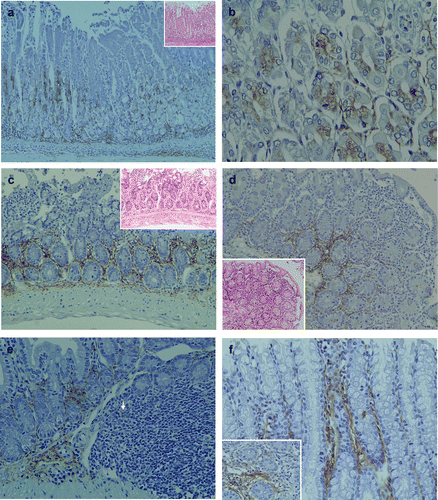 Figure 2 Pathological findings and immunohistochemical staining of LTA in the gastrointestinal tract of TCRα− / − × AIM− / − mice. (a) In the stomach, mild polymorphic inflammatory cellular infiltrates were observed in both mucosal and submucosal layers in all of the TCRα− / − × AIM− / − mice. LTA immunoreactivity was detectable in the proper mucosal layer. LTA was localized in the cytoplasm of both the fundic gland epithelial cells at the basal regions and polymorphic inflammatory cells. In the submucosal layer, immunoreactivity to LTA was observed in the cytoplasm of inflammatory cells and the stromal connective tissues. (b) At a higher magnification, LTA was localized in the cytoplasm of both the fundic gland epithelial cells at the basal regions. (c) In the small intestines of TCRα− / − × AIM− / − mice, mild to moderate polymorphic inflammatory cellular infiltrates were observed in the mucosal layers (H&E, on the higher right corner). In the proper mucosal layer, LTA immunoreactivity was located in the cytoplasm of inflammatory cells at the basal lesions. (d) In another TCRα− / − × AIM− / − mouse, mild to moderate polymorphic inflammatory cellular infiltrates were observed in the mucosal layers of the small intestine (H&E, on the lower left corner). In the proper mucosal layer, LTA immunoreactivity was located in the cytoplasm of inflammatory cells at the basal lesions. (e) In the submucosal layer, LTA immunoreactivity was observed in the connective tissue and in the cytoplasm of some of the inflammatory cells (arrow) in Peyer's patches. (f) In the colon, LTA immunoreactivity was detectable in the colon of all TCRα− / − × AIM− / − mice. LTA was detected in the cytoplasm of mucosal inflammatory cells and in the connective tissue of the proper mucosal layer.