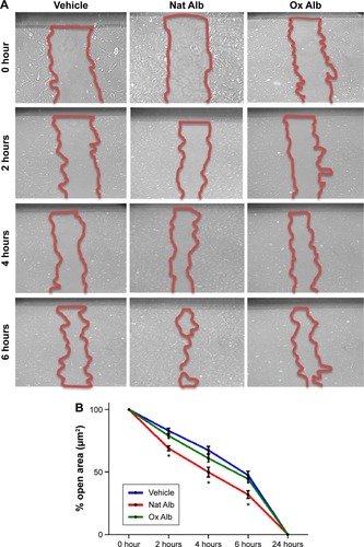 Figure 6 HUVEC with Nat Alb and Ox Alb (2 mg/mL) were scratched and wound margins were imaged from 0 up to 24 hours later.