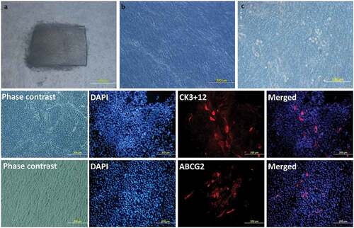 Figure 3. Limbal Explant Culture on the amniotic membrane: After attaching the explants to the hAM membrane, slow growth can be seen around the explant till the whole membrane is fully covered. Day 2 (a), Day 9 (b), Day 15 (c). Phenotypic marker expression by LESCs. LESCs showing positive expression of the CK3 + 12, their native phenotypic marker and ABCG2, stem cell marker, on day 9 of culture.